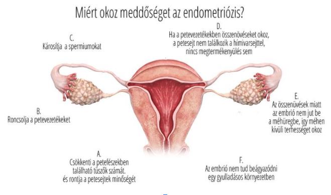 meddeddoseg endo