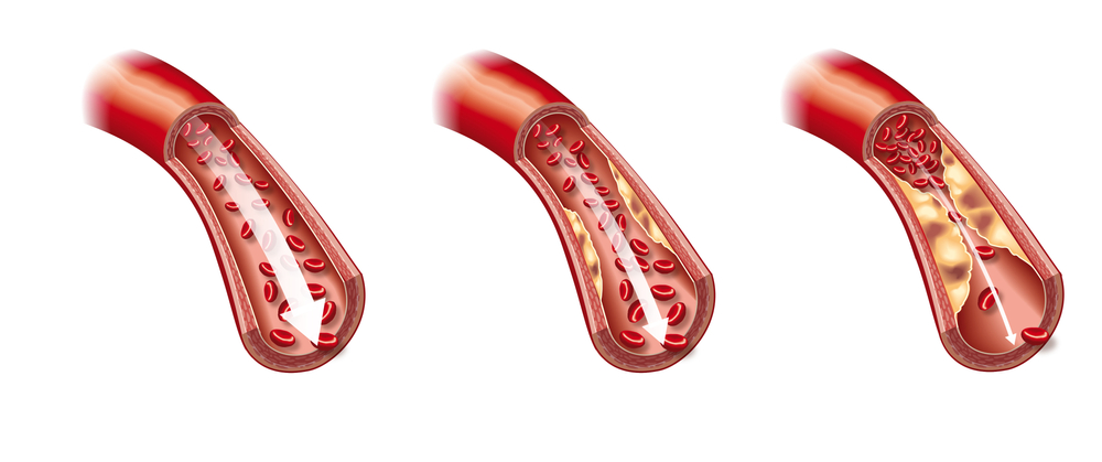 shutterstock 1680685423